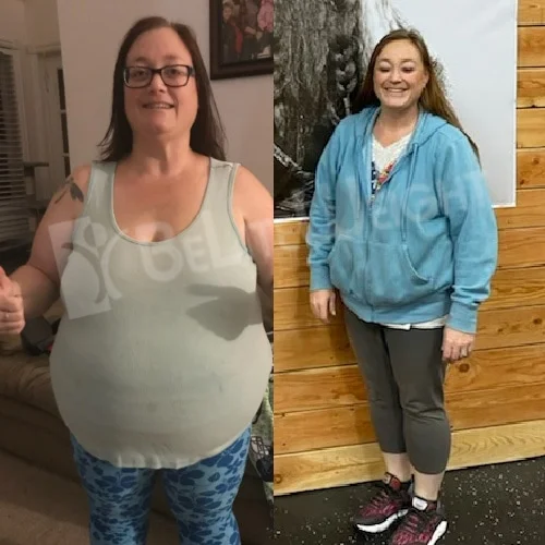 Holly G - 1 Year Update*